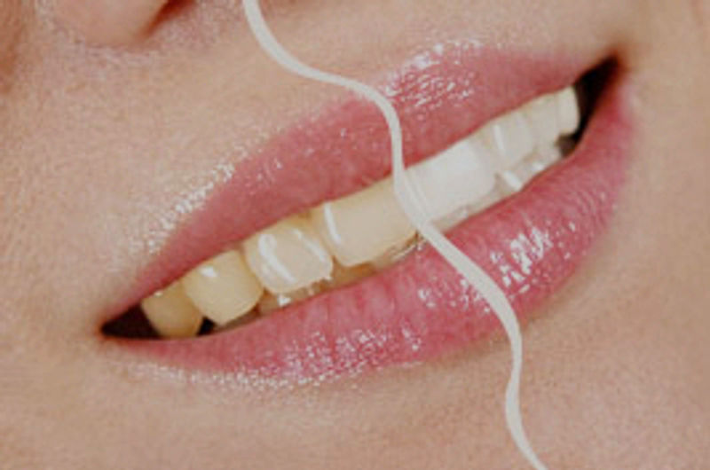Professional teeth whitening shade enhancement results